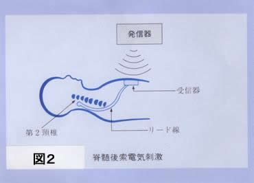 図2